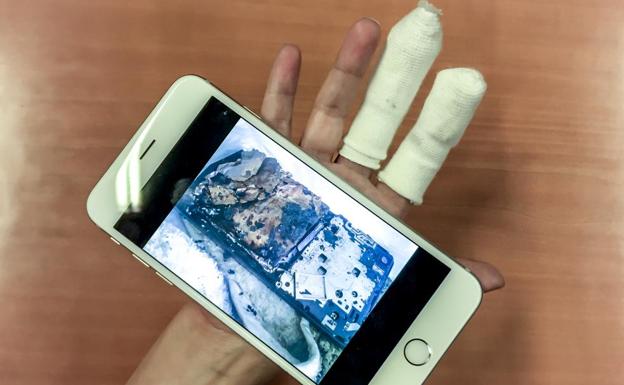 N.R. muestra su mano herida mientras sostiene una foto del móvil calcinado.