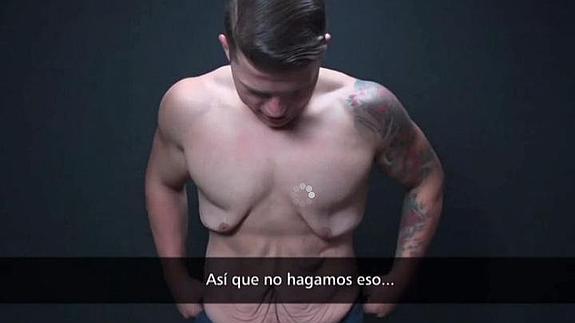 Como adelgazar sin que se cuelgue la piel